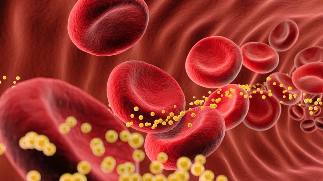Advanced Genetic Programming: Single Dose Slashes 'Bad' Cholesterol by 62%